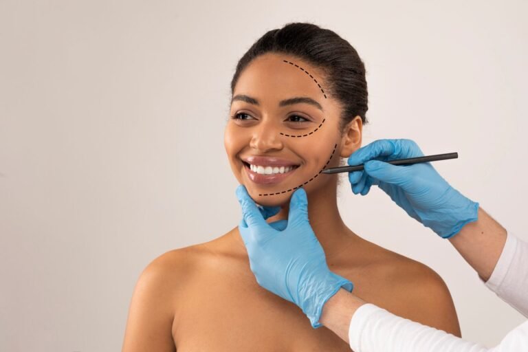 Perfiloplastia