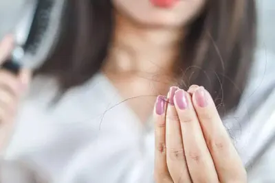 Queda de Cabelo