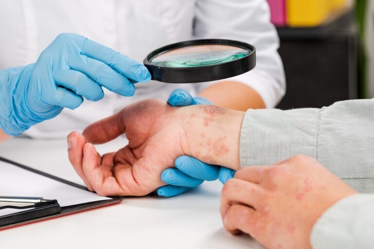 Tratamento para Dermatite
